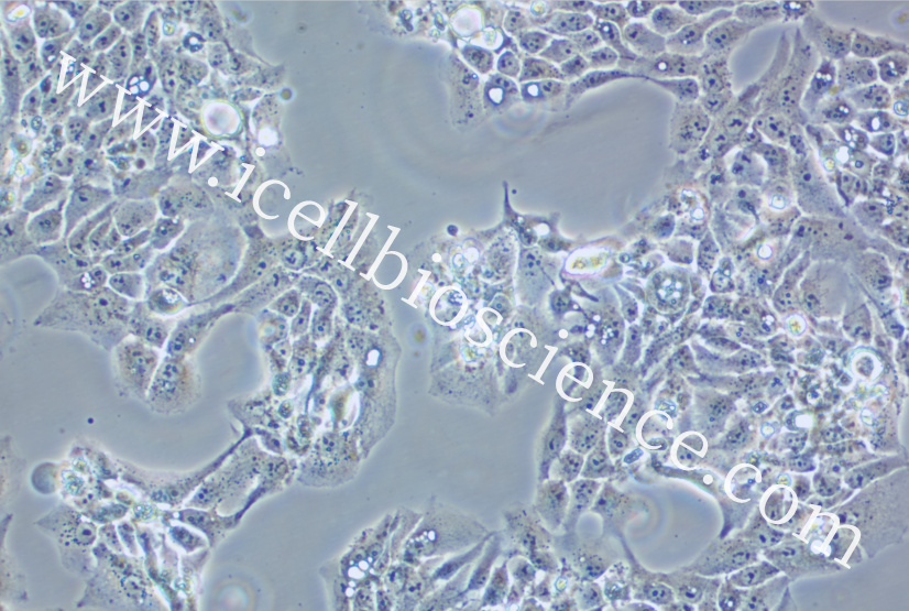 CAL33细胞、CAL-33细胞、CAL-33、CAL33、