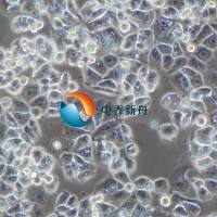 AU565人乳腺癌细胞