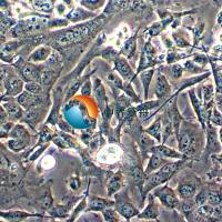 NCI-H1975人肺腺癌细胞