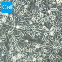 OV-90细胞、OV90细胞、OV-90、OV90、人卵巢癌细胞/STR鉴定