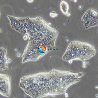 T84人结肠腺癌肺转移细胞