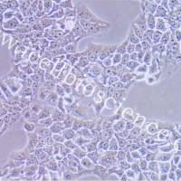 KYSE-510细胞、KYSE510细胞、KYSE-510、KYSE510、人