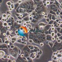 ZR-75-30 人乳腺癌细胞