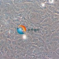 HBL-100人整合SV40基因的乳腺上皮细胞