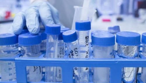 【实验指南】RNase酶污染问题注意事项