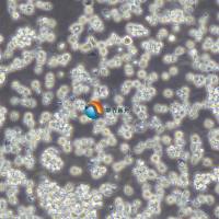 SUP-B15人Ph+急淋白血病细胞系