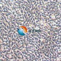 IMR-32人神经母细胞瘤细胞