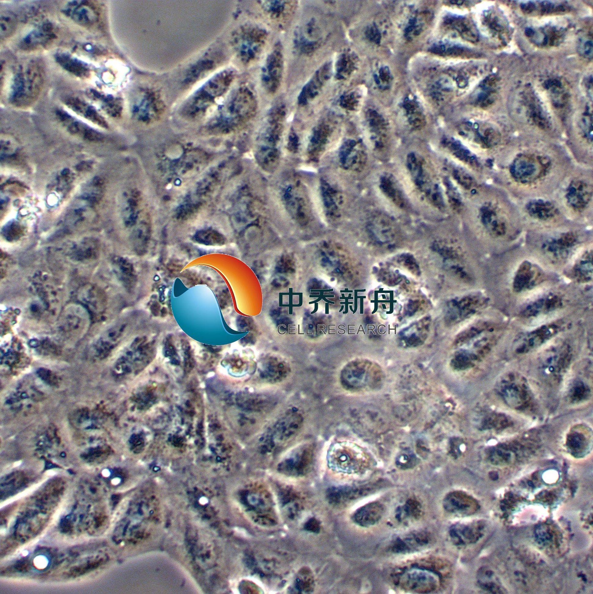 ACHN人肾细胞腺癌细胞