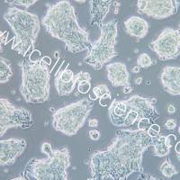 NCI-H1688/NCI-H1688细胞/NCI-H1688/人典型小细胞肺癌细胞/STR鉴定