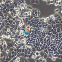 HEC-1-B人子宫内膜腺癌细胞