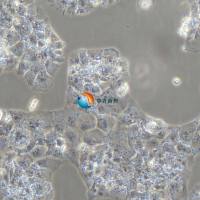 JAR人胎盘绒毛癌细胞