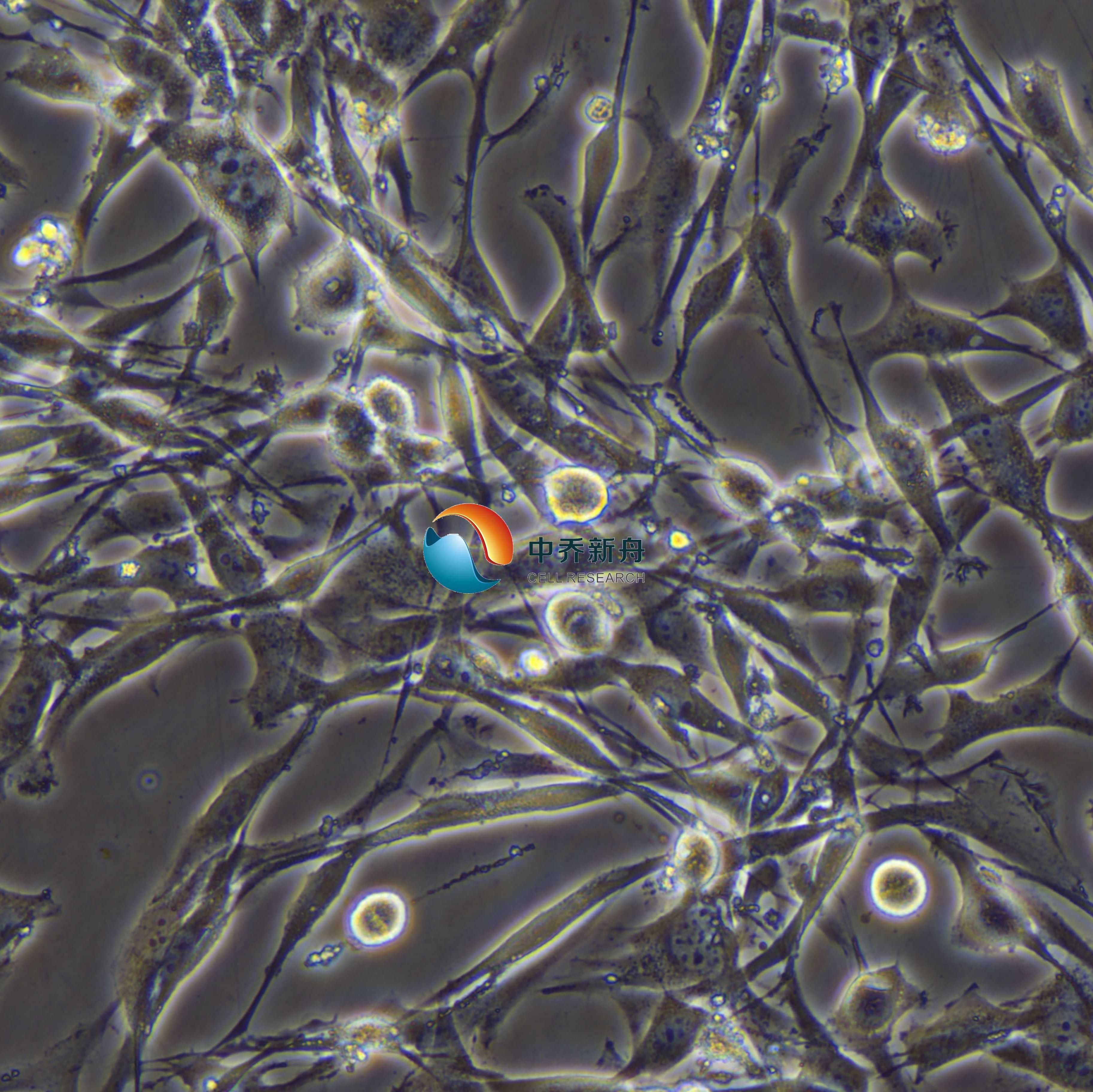 U-118 MG人脑星形胶质母细胞瘤