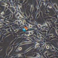 U-118 MG人脑星形胶质母细胞瘤