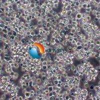 A3人T淋巴细胞白血病细胞