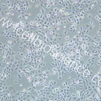 NPC/HK-1细胞、NPC/HK-1细胞、HK-1细胞、HK-1、人鼻咽癌细胞/STR鉴定/镜像