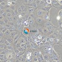 JEG-3人绒毛膜癌细胞