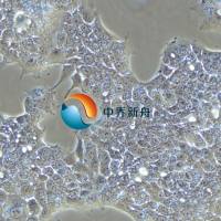 HCC827人非小细胞肺癌细胞