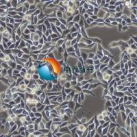 RKO人结肠腺癌细胞