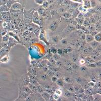 HEC-1-A人子宫内膜腺癌细胞