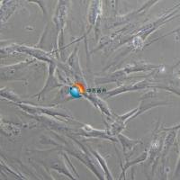 HFL1人胚肺成纤维细胞