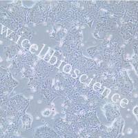 T84细胞、T-84细胞、T84、T-84、人结肠腺癌肺转移细胞/STR鉴定/镜像绮点(Cellverse)