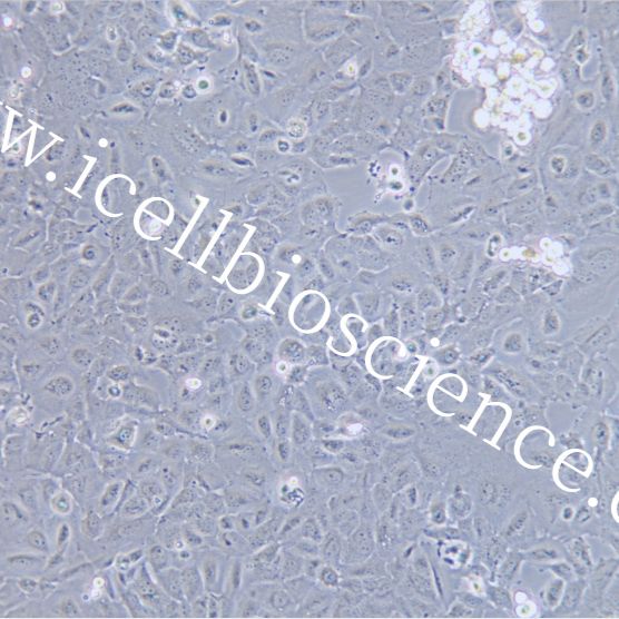 KYSE-520细胞、KYSE520细胞、KYSE-520、KYSE520、人食管鳞癌细胞/STR鉴定