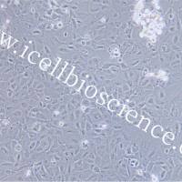 KYSE-520细胞、KYSE520细胞、KYSE-520、KYSE520、人食管鳞癌细胞/STR