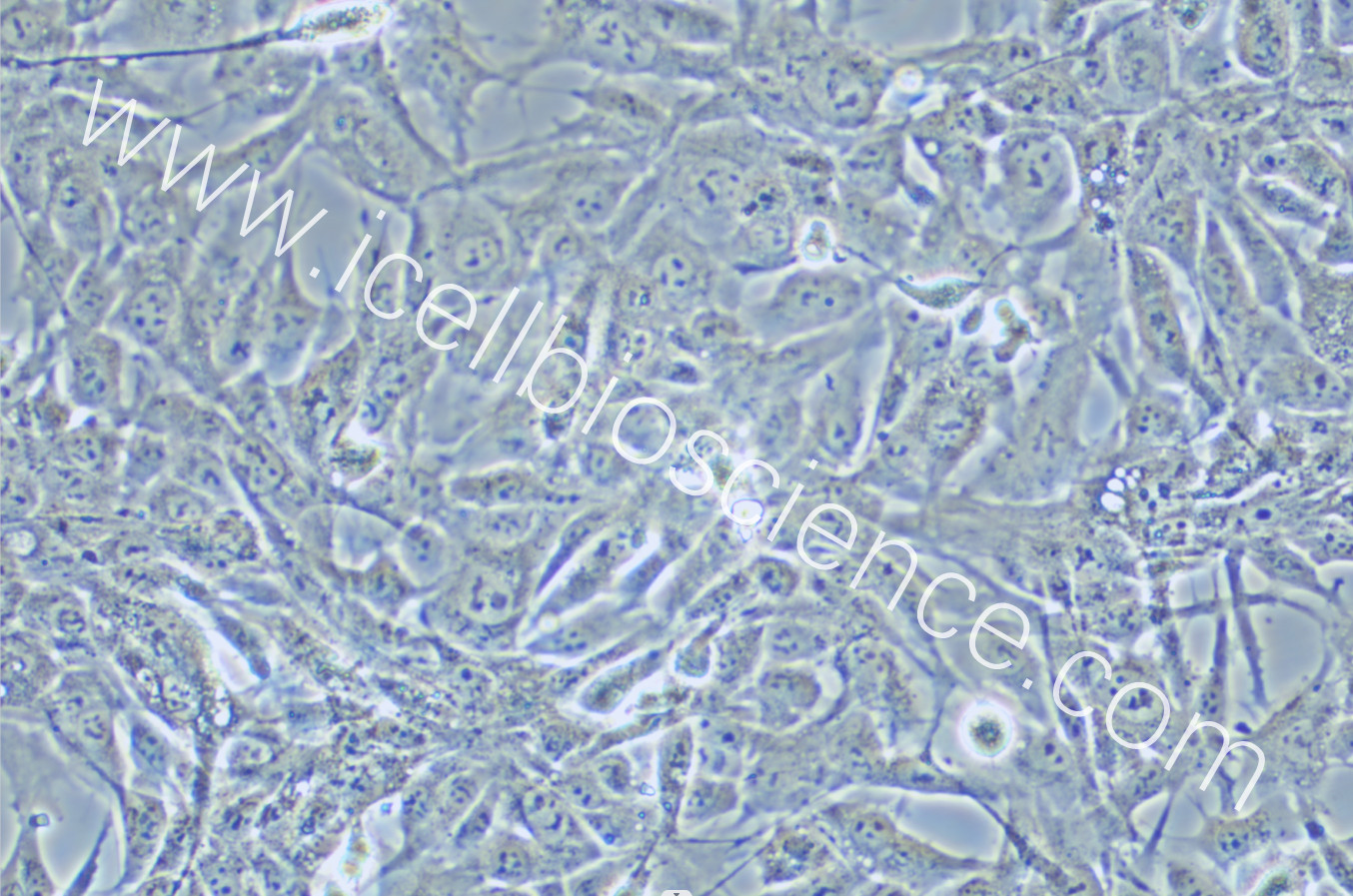 HEY A8细胞 | HEY-A8细胞 | HEY-A8 |