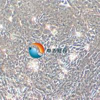 HCT-8 [HRT-18]人回盲肠癌细胞