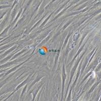 CCD-1095Sk人乳腺浸润性导管癌旁皮肤细胞