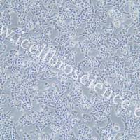 RPMI-2650细胞、RPMI2650细胞、RPMI-2650、RPMI2650人鼻腔上皮细胞/STR鉴定