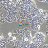 T-47D人乳腺管癌细胞