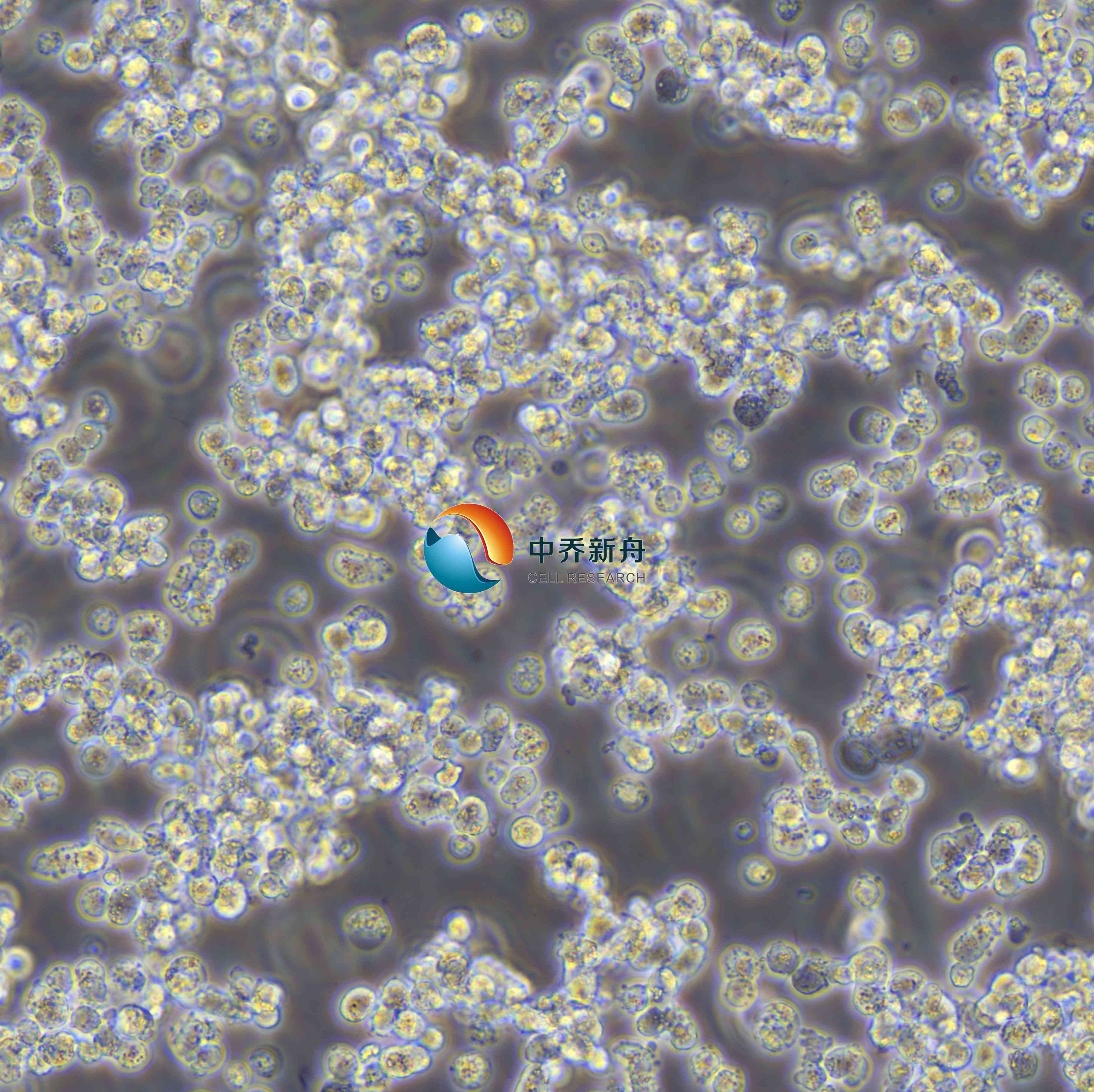 SK-NEP-1人肾母细胞瘤细胞