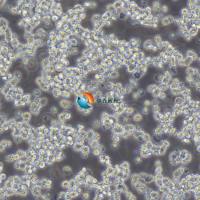 SK-NEP-1人肾母细胞瘤细胞