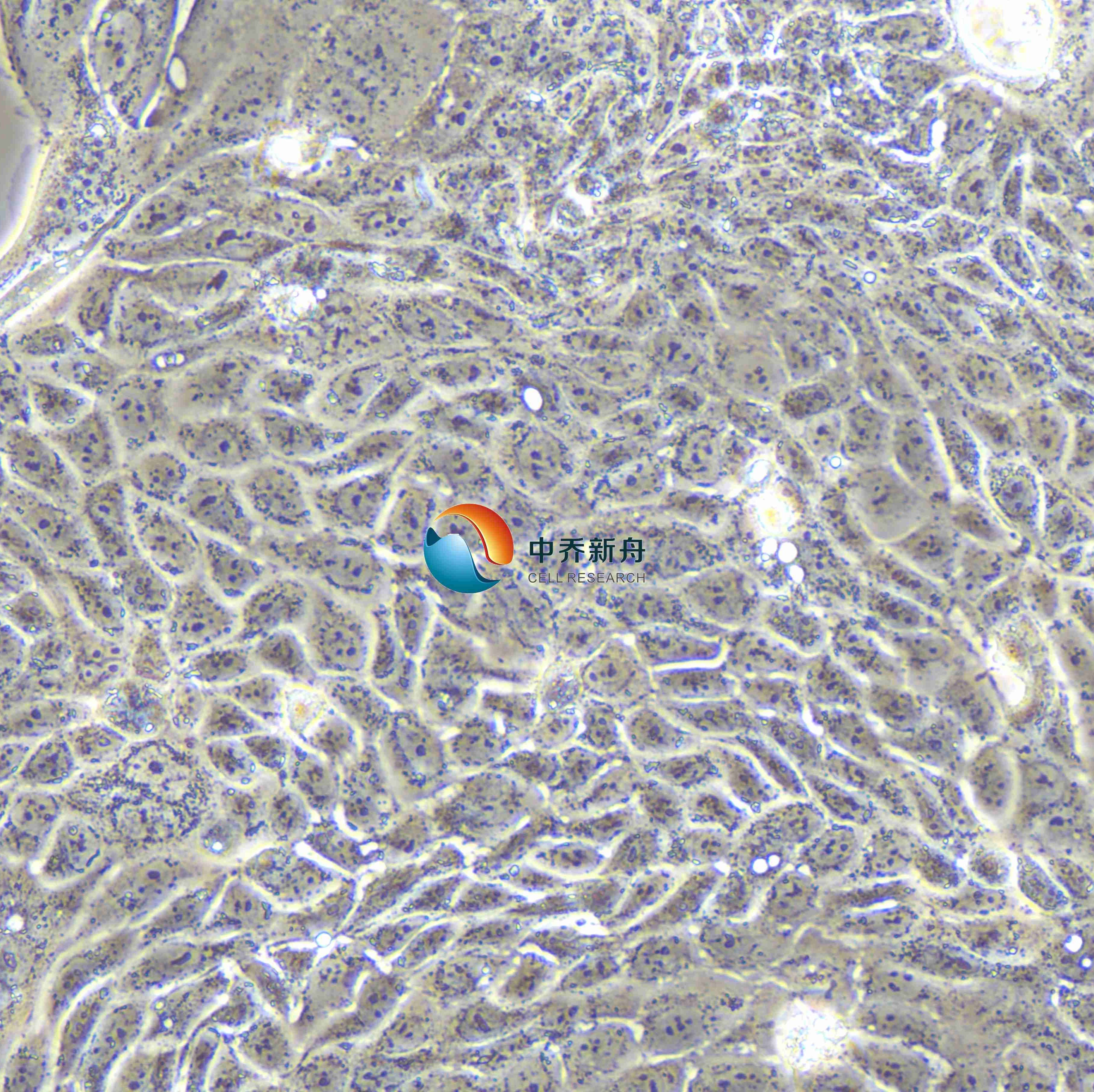 Calu-3人肺腺癌 (胸水)