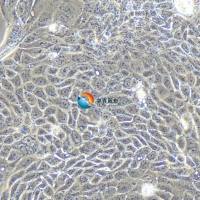 Calu-3人肺腺癌 (胸水)