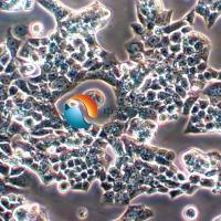 RL95-2人子宫内膜癌细胞