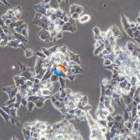 NCI-H295R人肾上腺皮质腺癌细胞