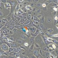 HCC1937人乳腺癌细胞