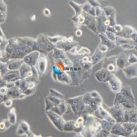 NCI-H1395人肺腺癌细胞