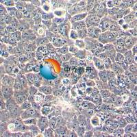 MS751人子宫颈表皮癌细胞