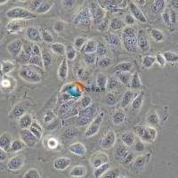 NIH:OVCAR-3人卵巢癌细胞