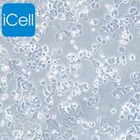 NCI-H2126/NCI-H2126细胞/H2126细胞/人肺癌细胞/STR鉴定