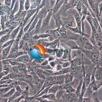 MNNG/HOS Cl #5 [R-1059-D]人骨肉瘤细胞