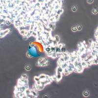 WERI-Rb-1人视网膜神经胶质瘤细胞