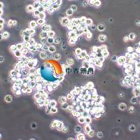 HuT 78人T淋巴细胞白血病细胞