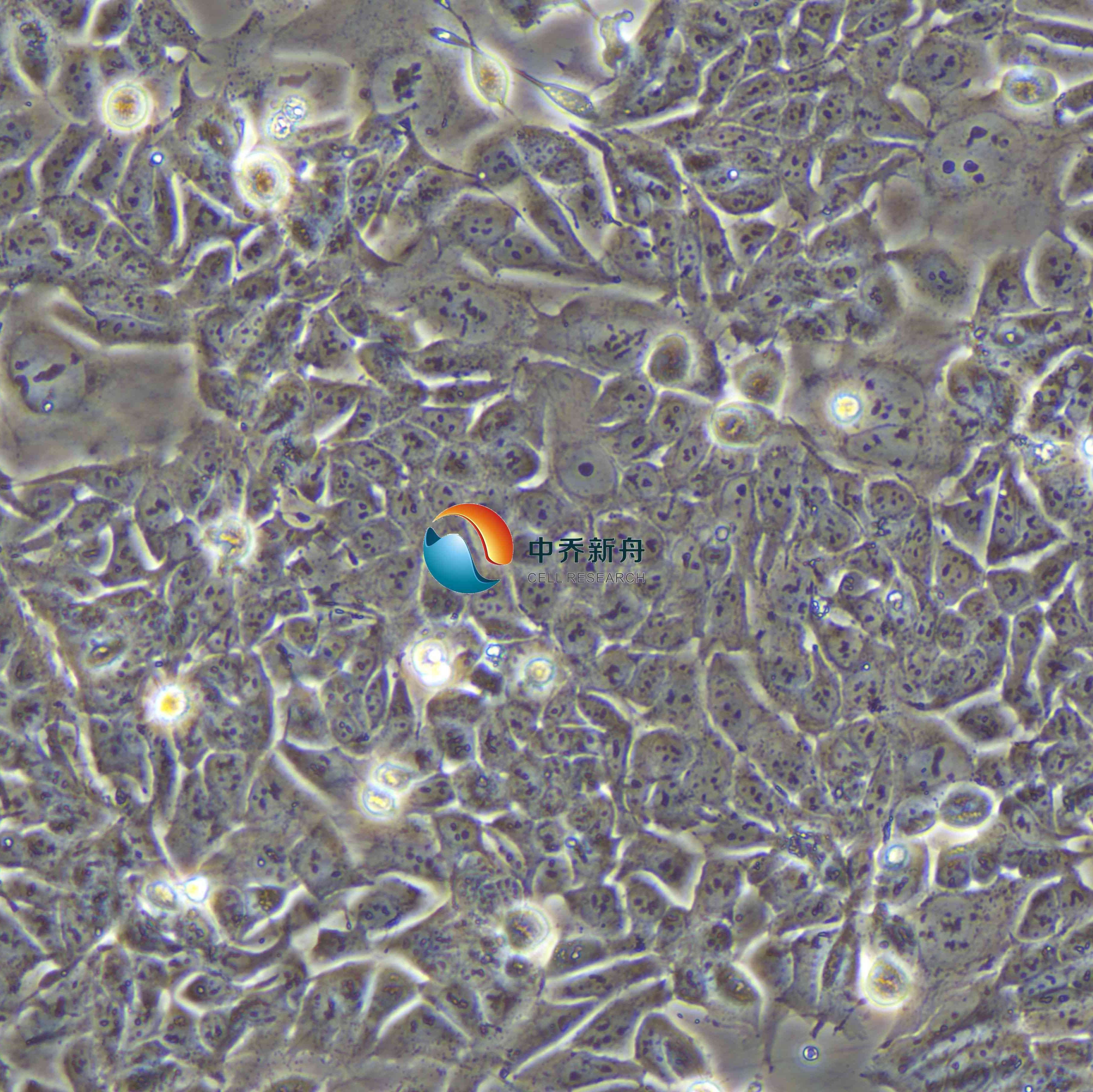 HCT-15人结直肠腺癌细胞