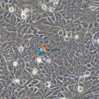 HCT-15人结直肠腺癌细胞