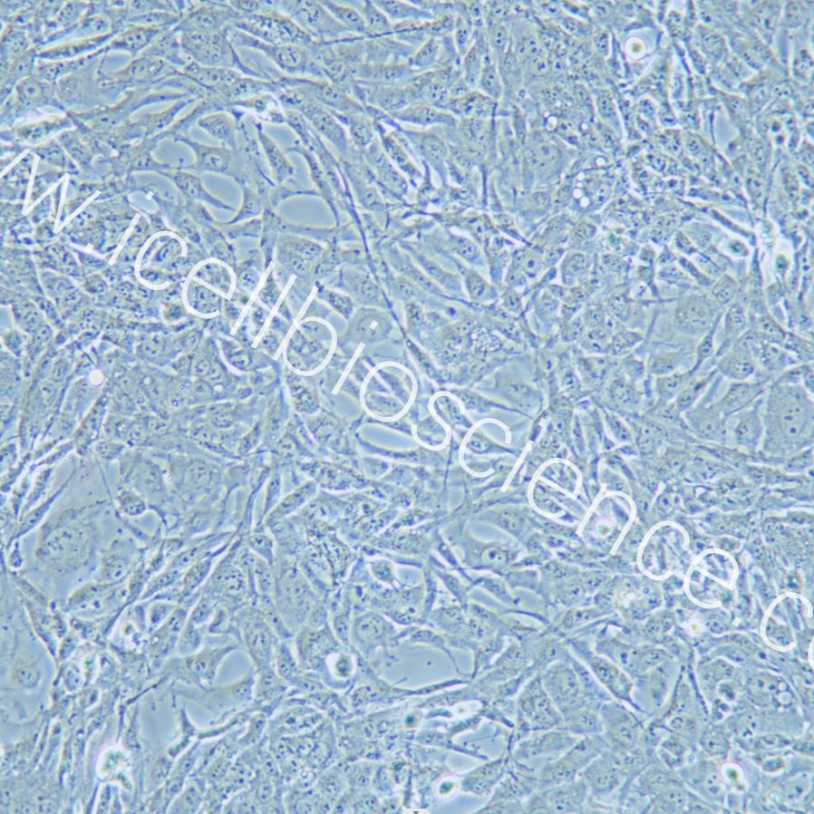 HEY A8细胞 | HEY-A8细胞 | HEY-A8 | HEY A8 | 人卵巢癌细胞 | STR鉴定 | 镜像绮点(Cellverse)