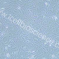 HEY A8细胞 | HEY-A8细胞 | HEY-A8 | HEY A8 | 人卵巢癌细胞 | STR鉴定 | 镜像绮点(Cellverse)